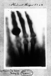 Roentgen's wife's hand.